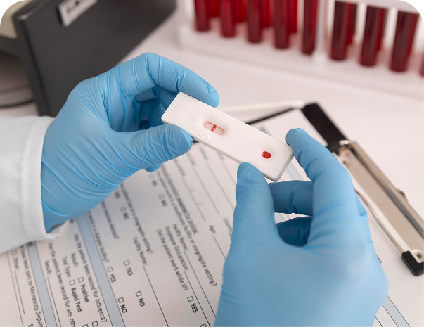 Beta HCG